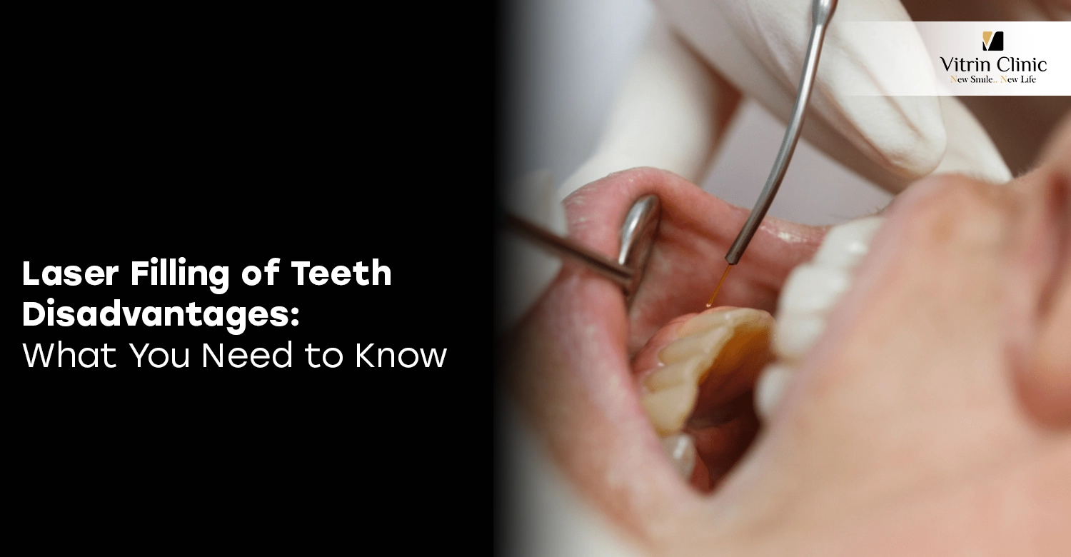 Laser Filling of Teeth Disadvantages
