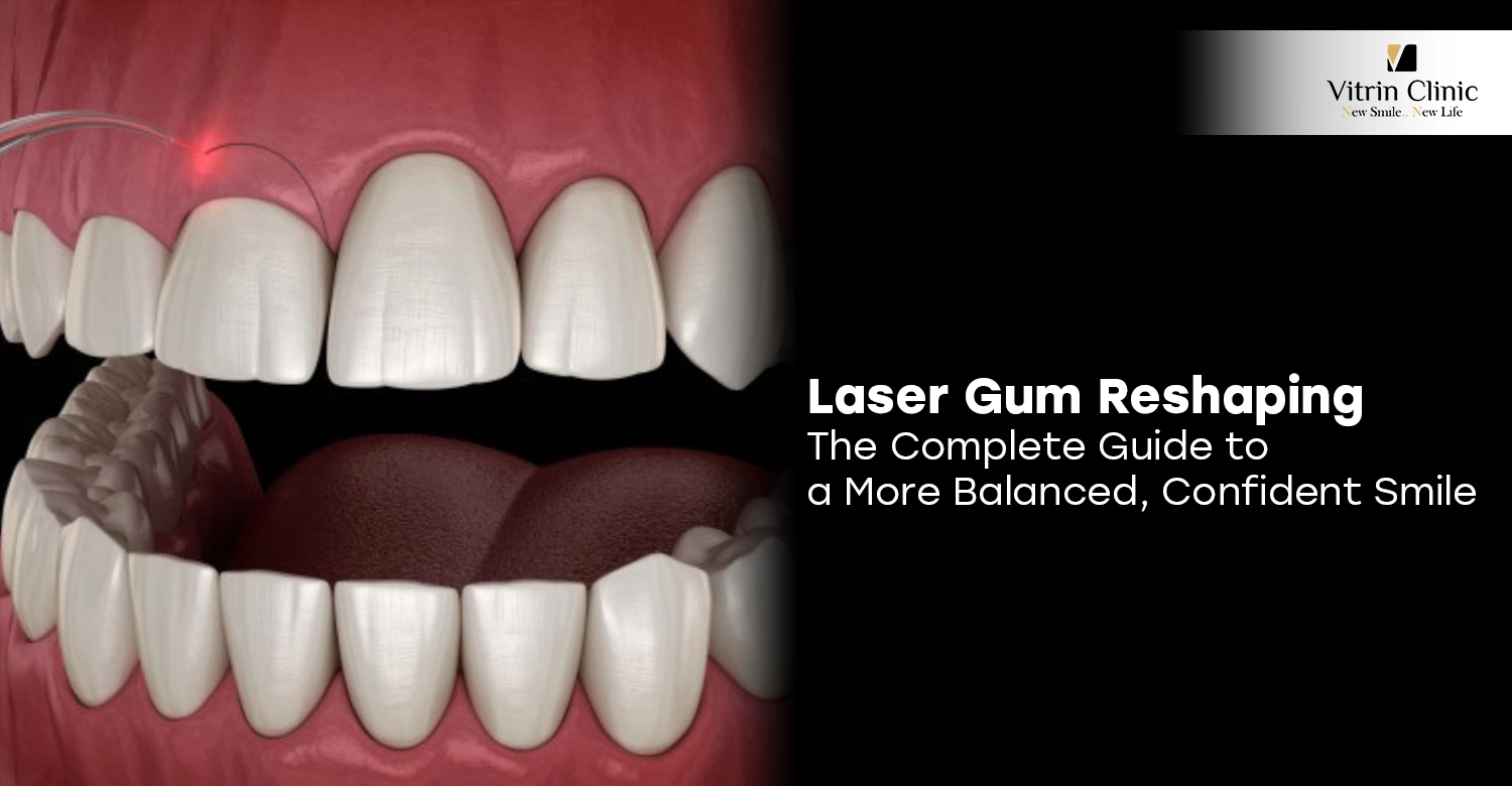 Laser Gum Reshaping