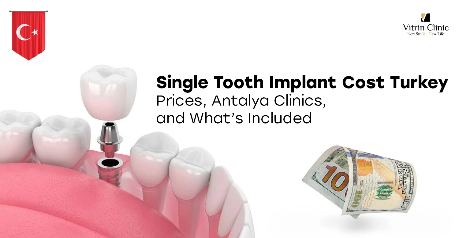 Single Tooth Implant Cost Turkey