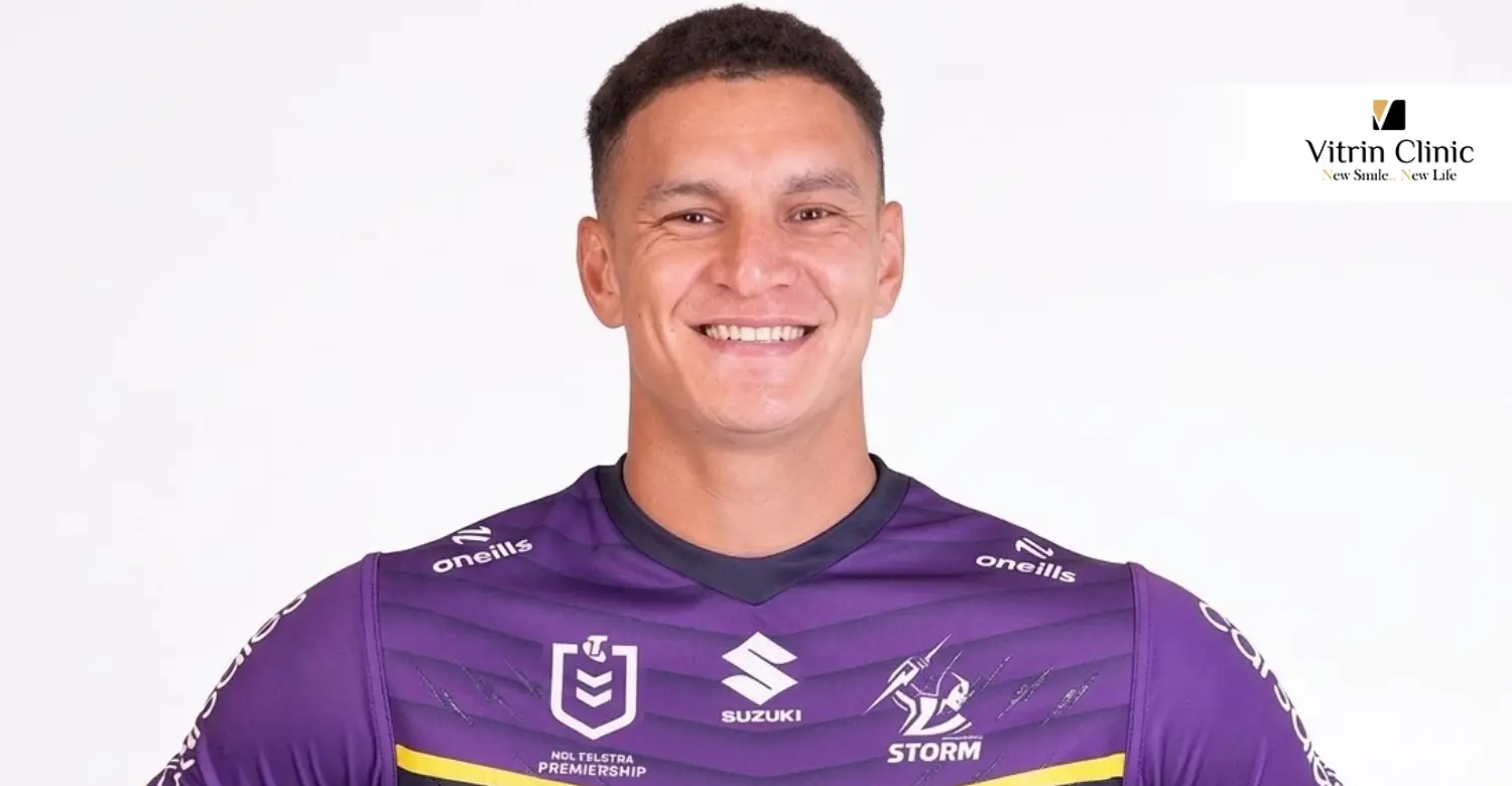 William Warbrick Smile