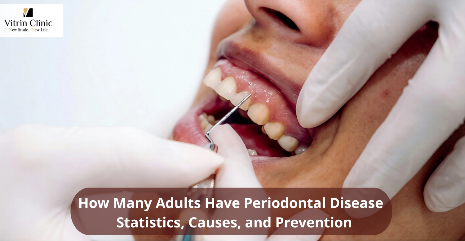 How Many Adults Have Periodontal Disease