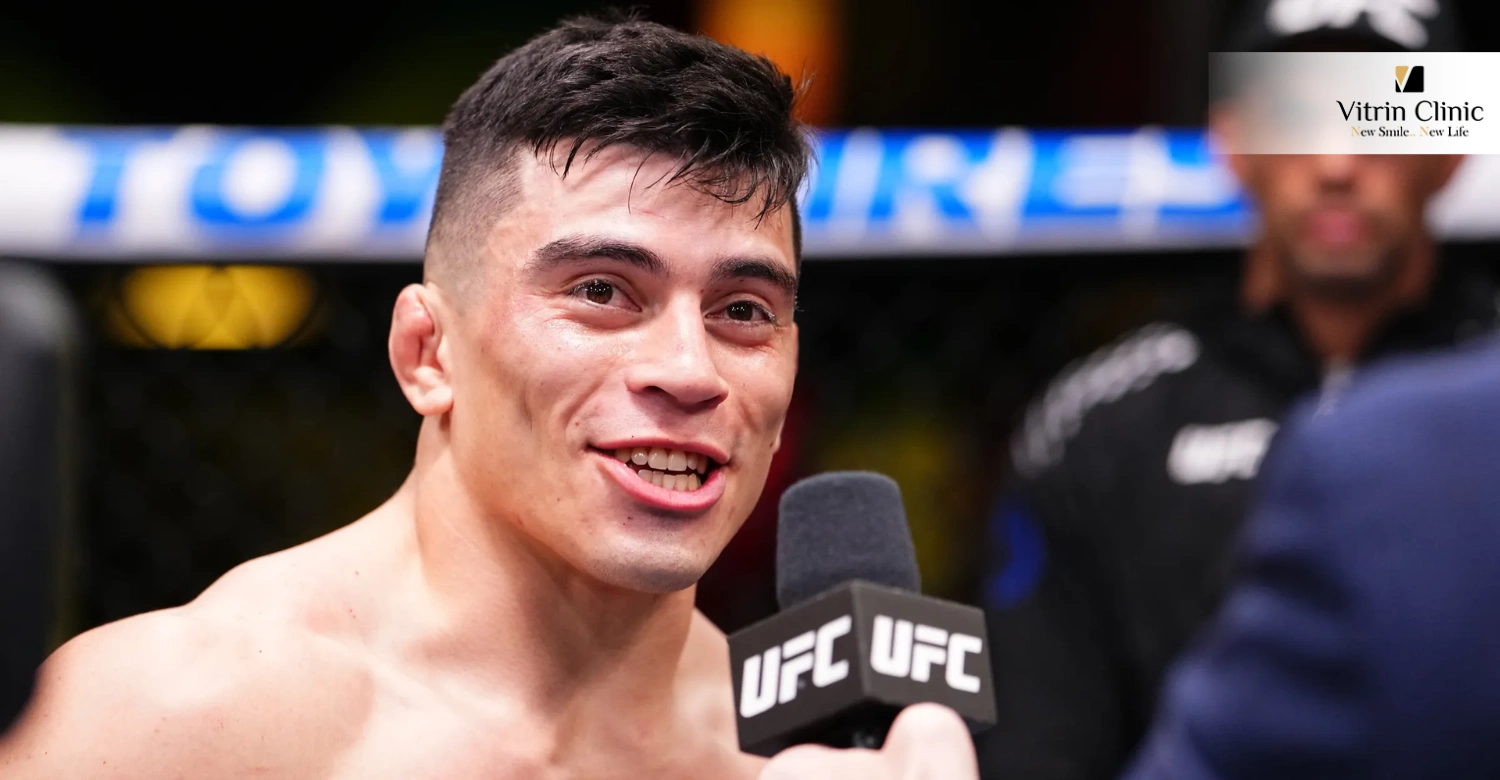 Kevin Vallejos Smile