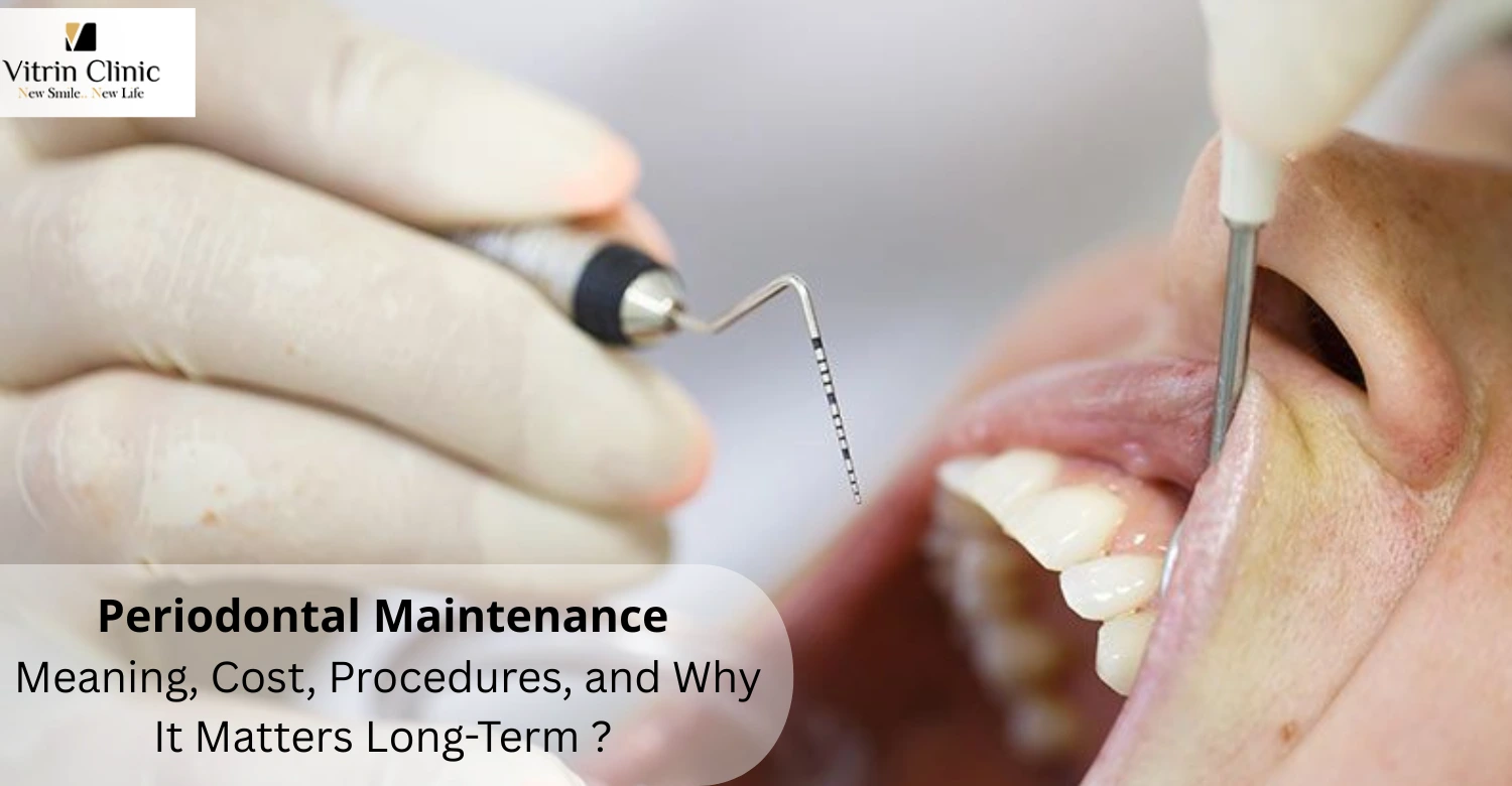 Periodontal Maintenance