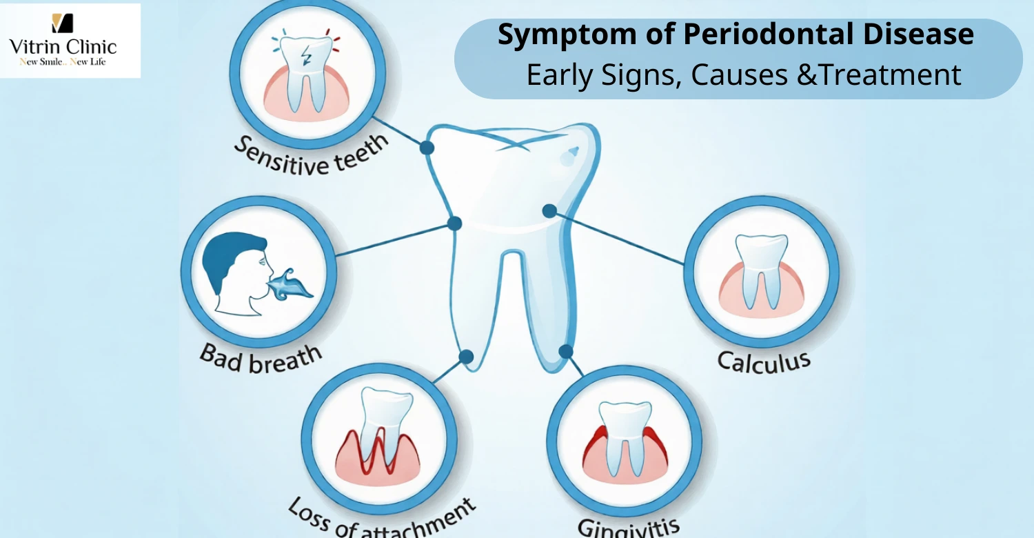 Symptom of Periodontal Disease